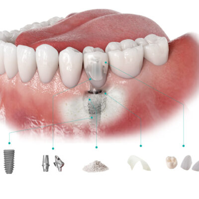ACTILINK™ motion, product image