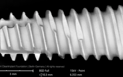 Dentis s-Clean SQ-SL, Overview