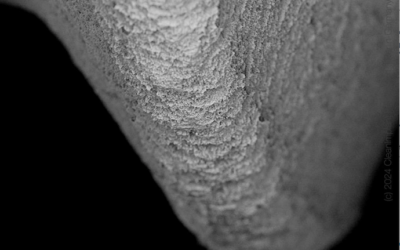 Dentis s-Clean SQ-SL, SEM