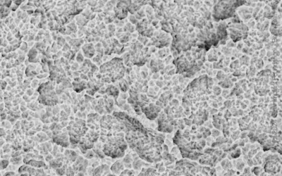 Dentis s-Clean SQ-SL, SEM
