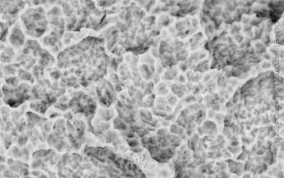 Dentis s-Clean SQ-SL, SEM