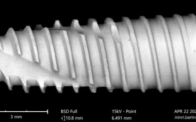Izen Implant Zenex, Overview