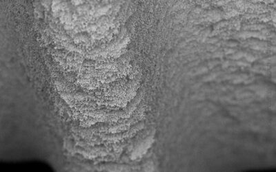 Izen Implant Zenex, Thread 500×