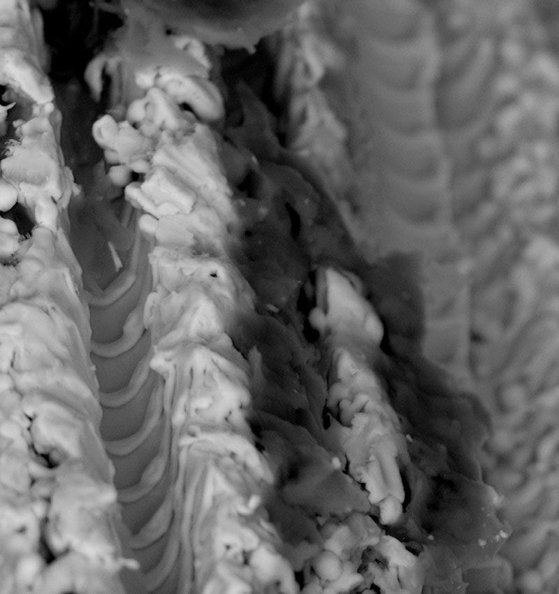 Implant surface at 5,000× magnification