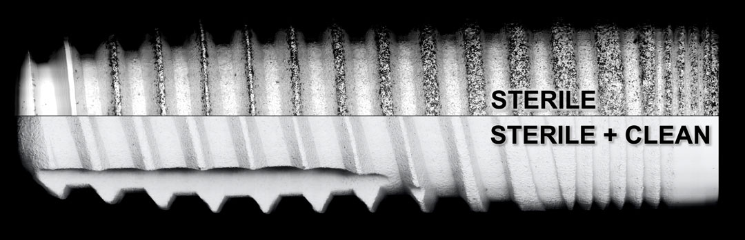 Two sterile-packaged dental implants show a different level of cleanliness in the SEM-mapping image, digitally composed from up to 600 single SEM images.