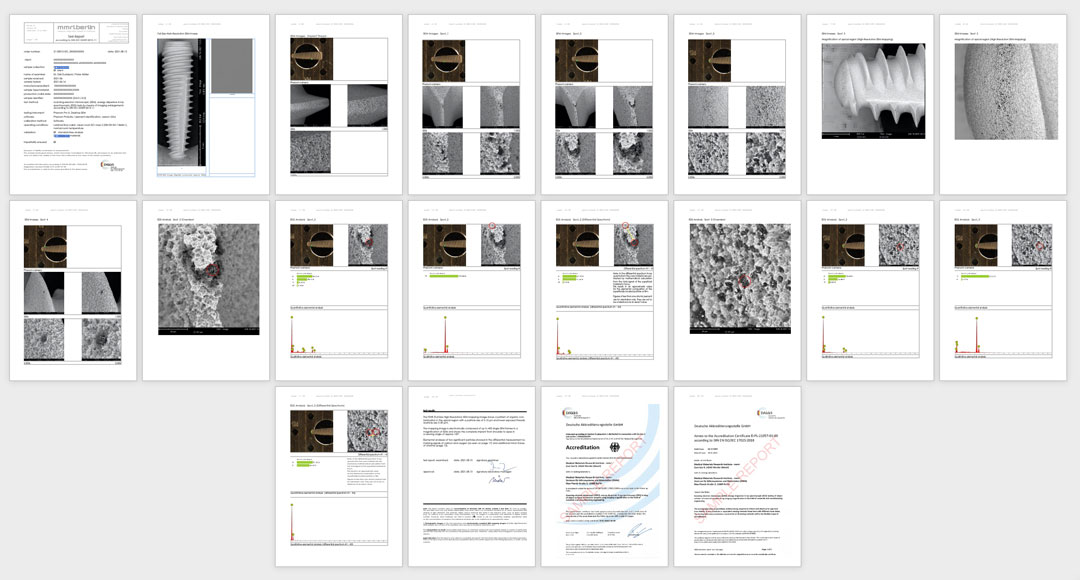 Example of a comprehensive testing report with SEM image magnifications up to 5,000x and elemental analysis by Energy Dispersive X-ray Spectroscopy (EDS) according to ISO 22309:2015.
