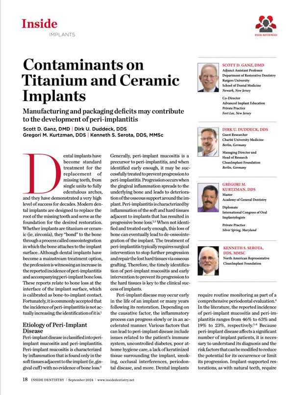 Contaminants on Titanium and Ceramic